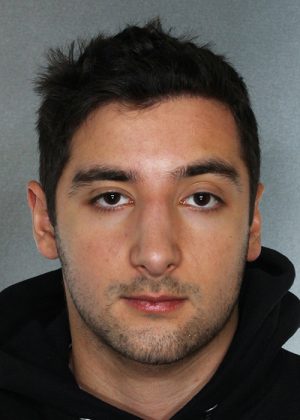 Rhinoplasty result at New York Plastic Surgery