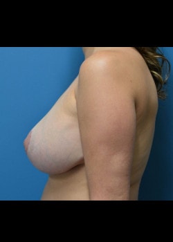 A result from Jessica Belz, MD