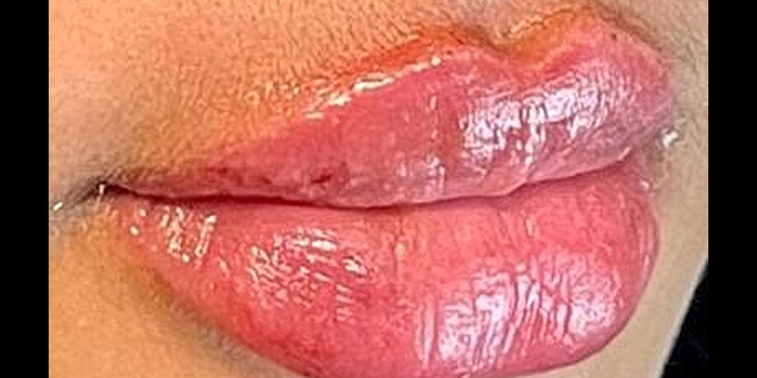 A result from Dr. Nip and Tuck (Plastic Surgery Inst)