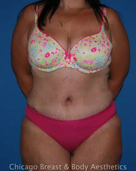 Chicago Breast & Body Aesthetics provider photo