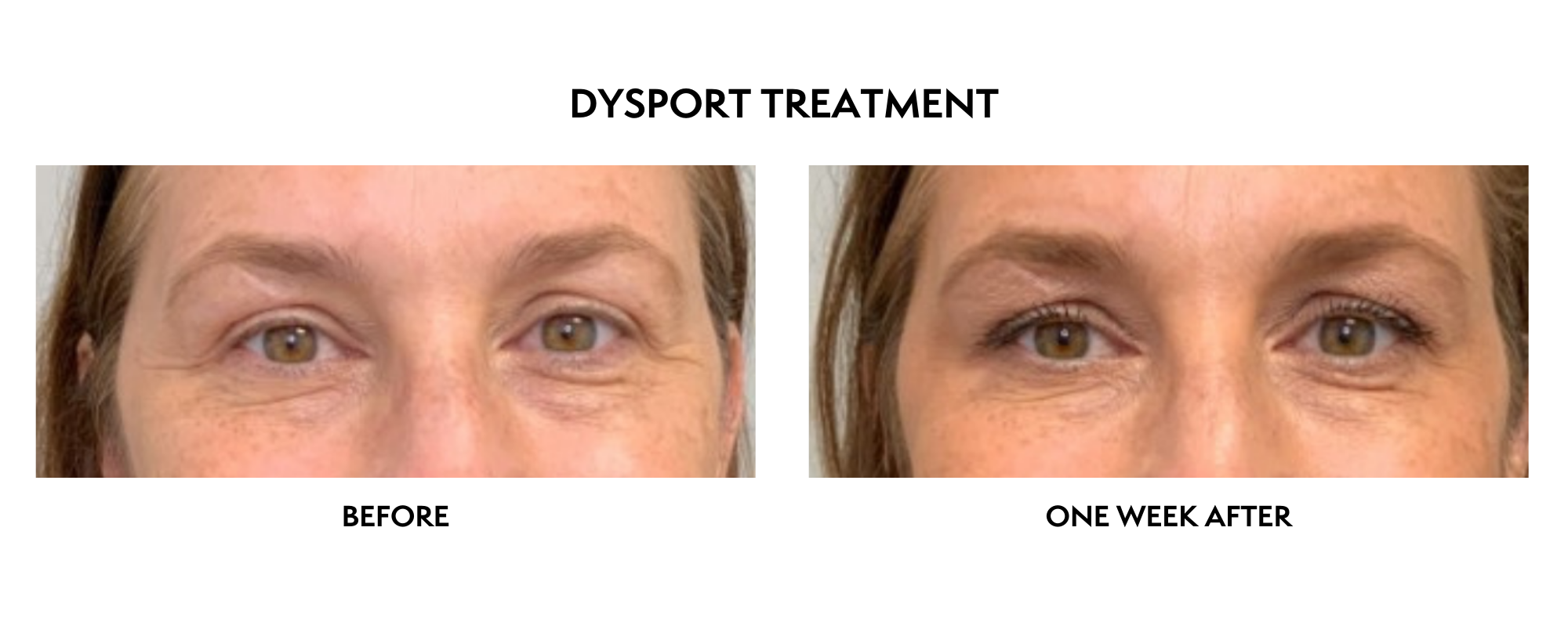 A result from ICON Dermatology and Aesthetics