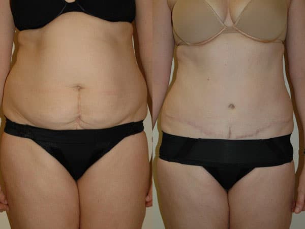 A result from Richard A. Bartlett M.D., P.C.