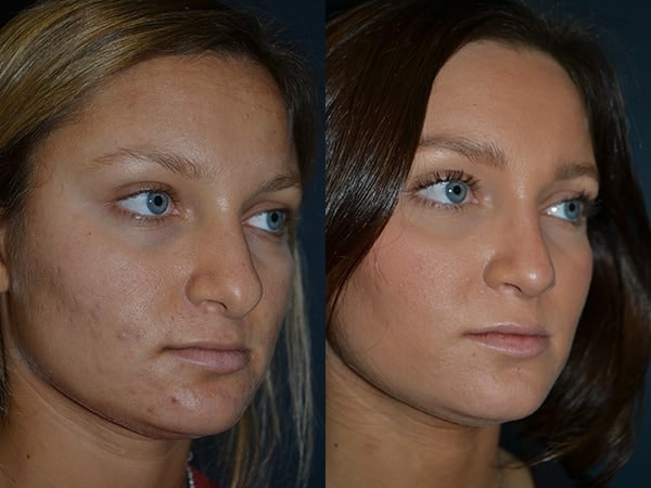 A result from Richard A. Bartlett M.D., P.C.