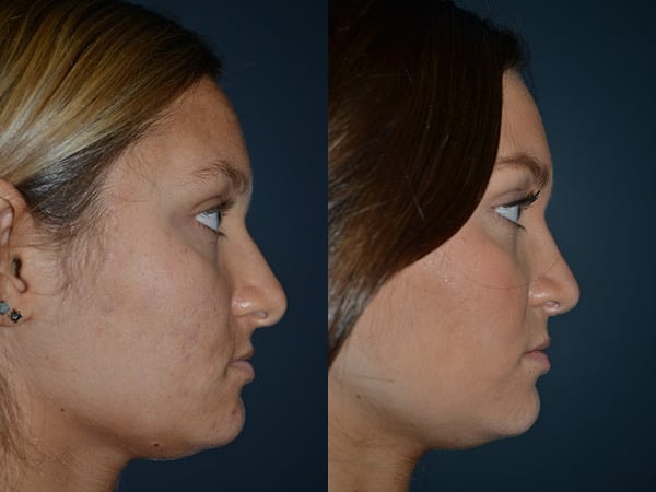 A result from Richard A. Bartlett M.D., P.C.