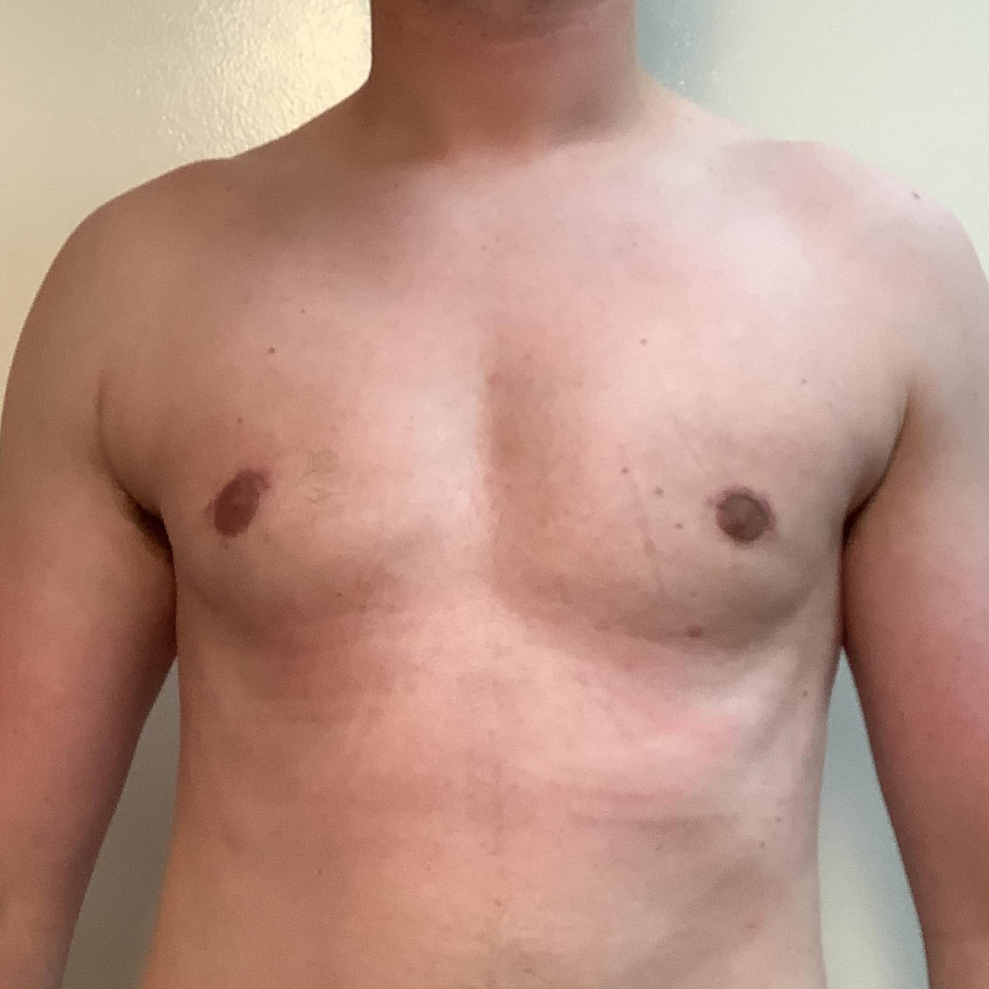 A result from Cascade Cosmetic Surgery Center