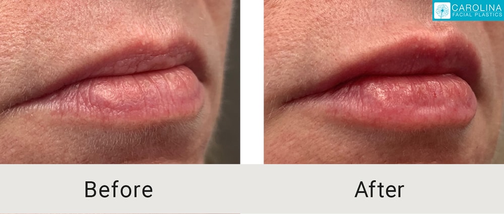 A result from Carolina Facial Plastics