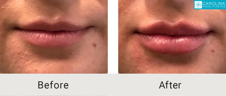 Carolina Facial Plastics provider photo