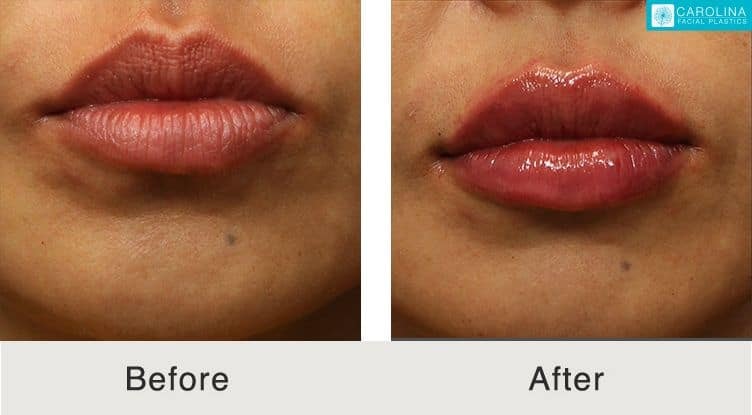 A result from Carolina Facial Plastics