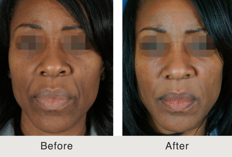 A result from Carolina Facial Plastics