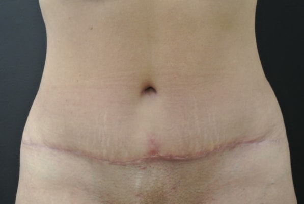 A result from June S. Chen, M.D., P.C.