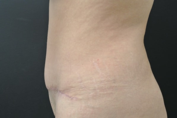 A result from June S. Chen, M.D., P.C.