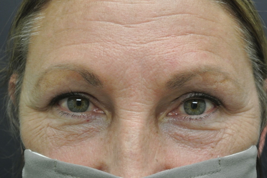 A result from June S. Chen, M.D., P.C.
