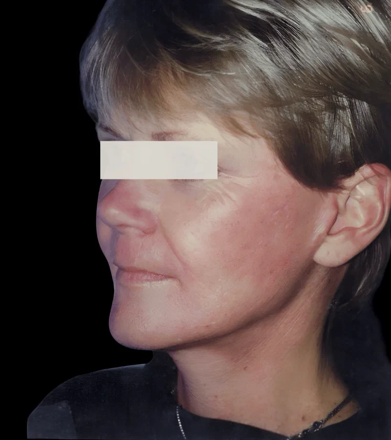 A result from Aesthetic Surgery Center: Michael R. Macdonald, M.D.