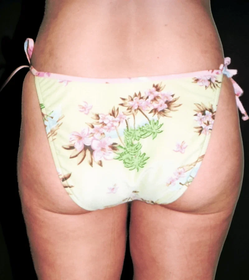 A result from Aesthetic Surgery Center: Michael R. Macdonald, M.D.