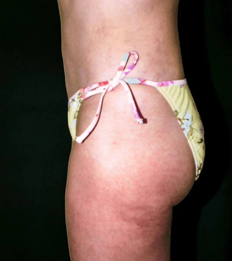A result from Aesthetic Surgery Center: Michael R. Macdonald, M.D.