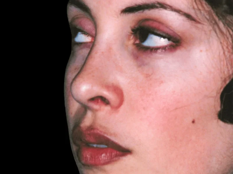 A result from Aesthetic Surgery Center: Michael R. Macdonald, M.D.