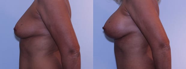 Westfield Plastic Surgery Center provider photo