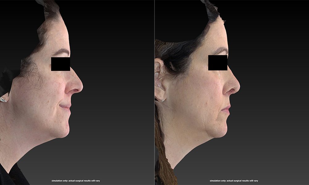Westfield Plastic Surgery Center provider photo