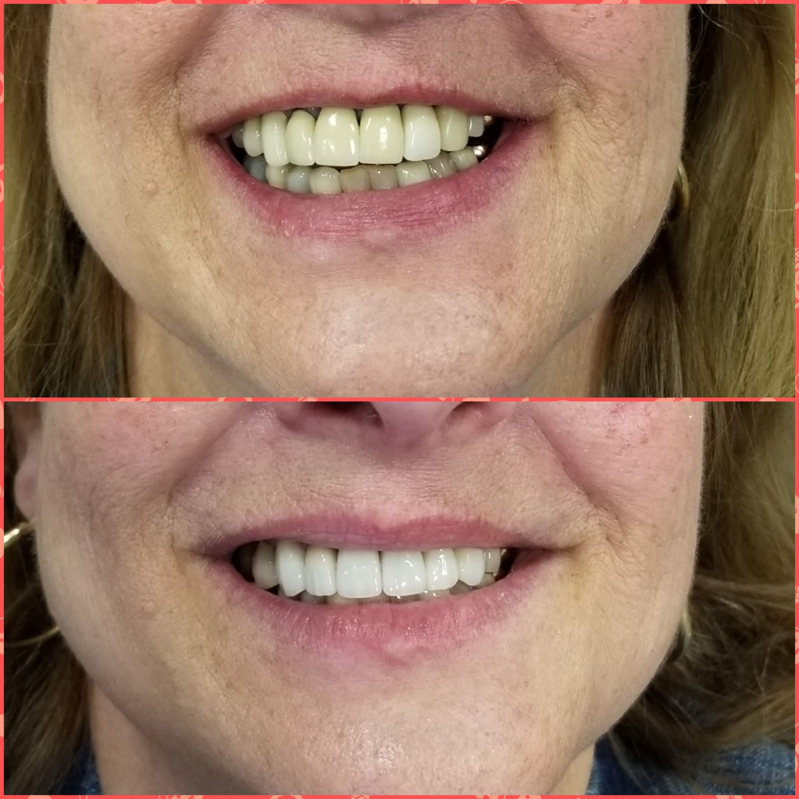 A result from Gunnell Family Dentistry