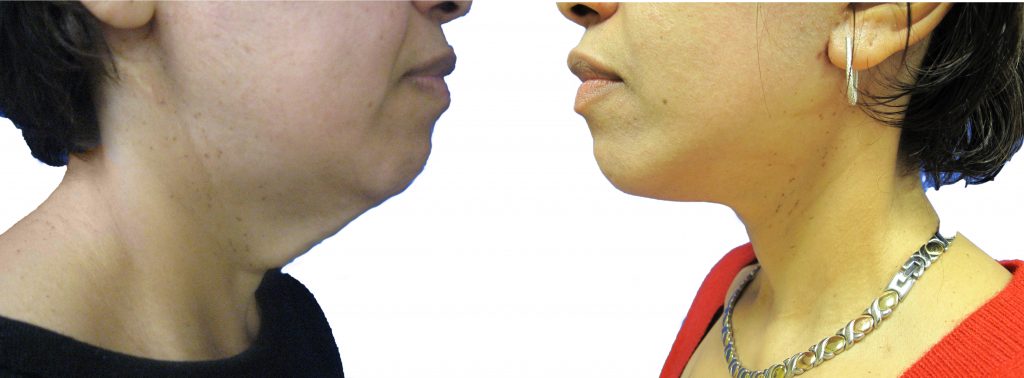 A result from Dr. Tal Dagan, MD, FACS