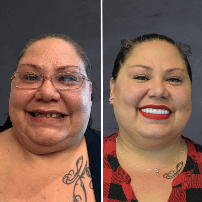 A result from Stubbs Dental Implant Center