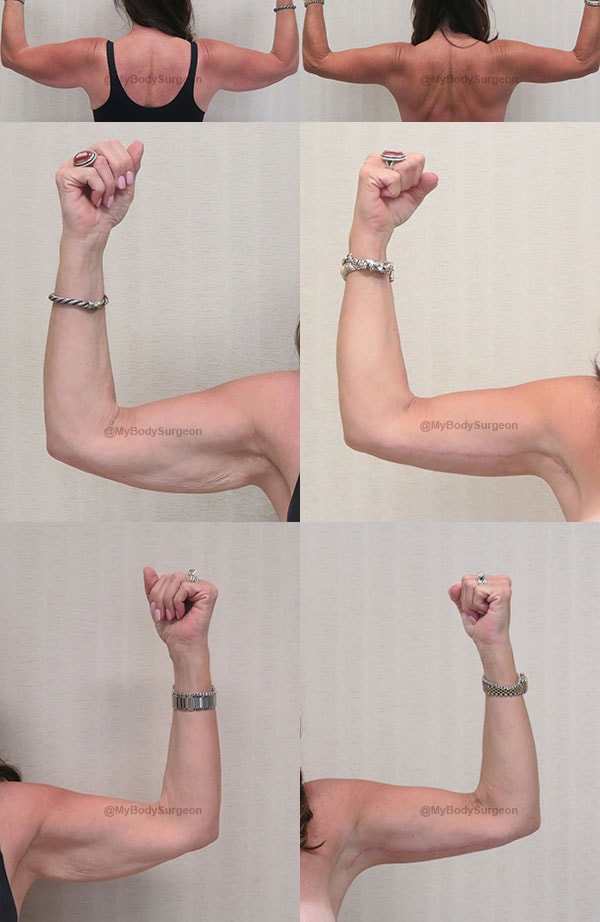 A result from Sugar Land Plastic Surgery