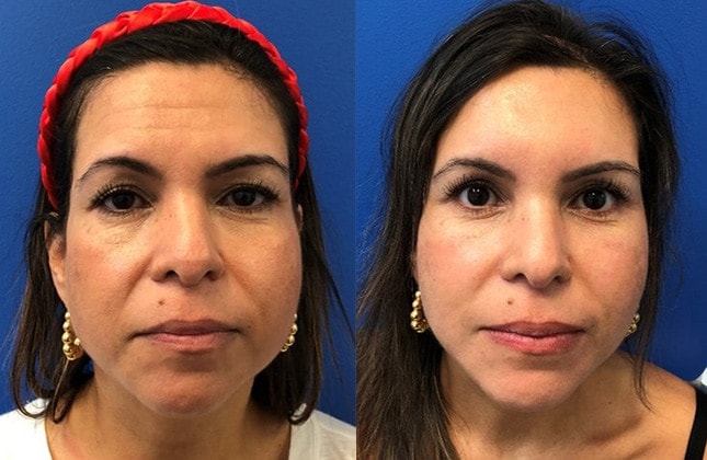 A result from Andrew P. Amunategui, MD