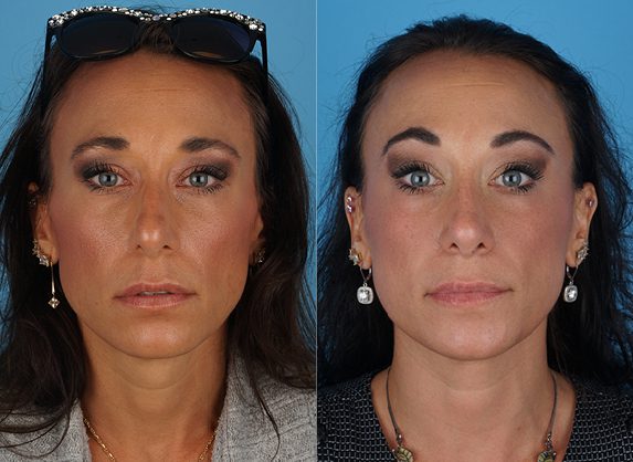 Jefferson Facial Plastics provider photo