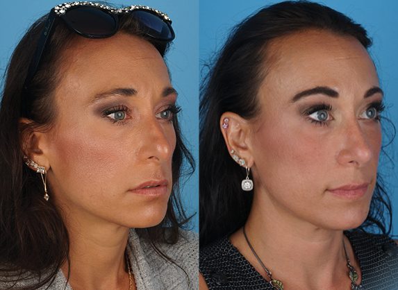 A result from Jefferson Facial Plastics