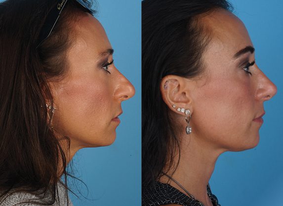 A result from Jefferson Facial Plastics