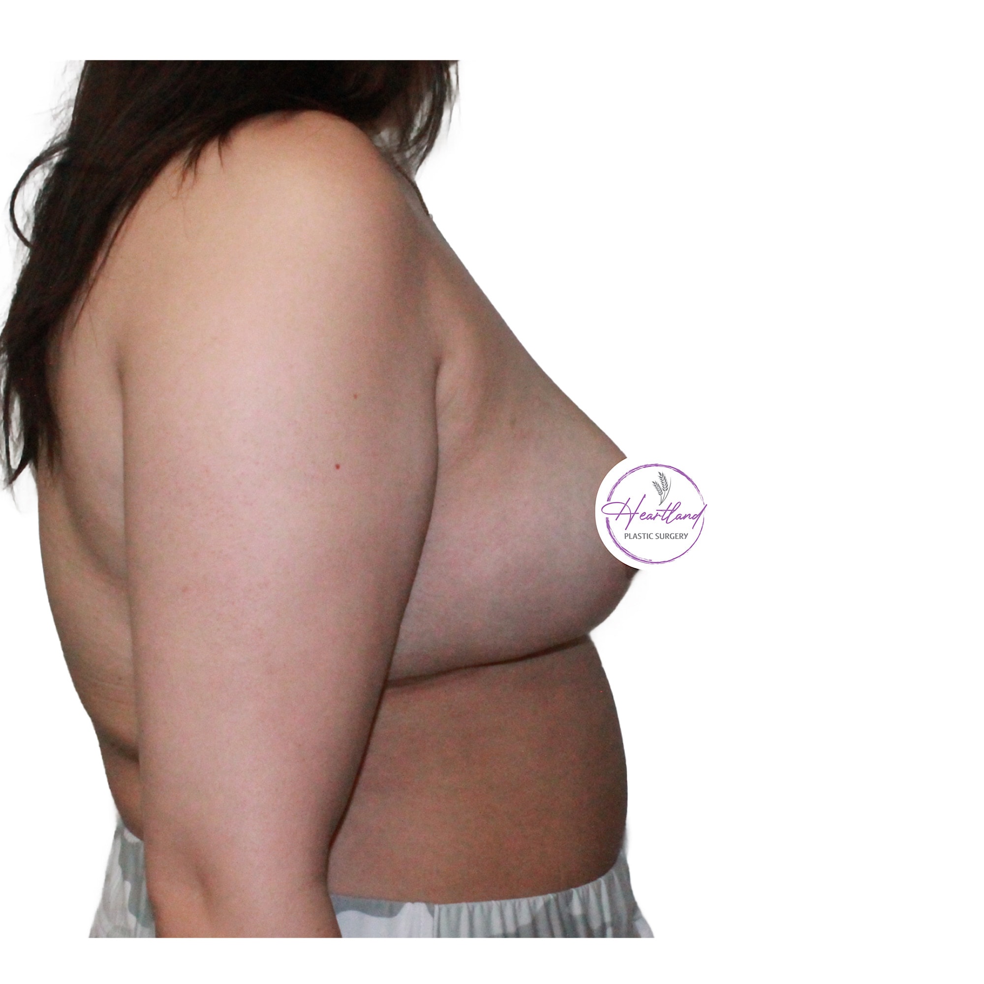 A result from Dr. Nataliya Biskup