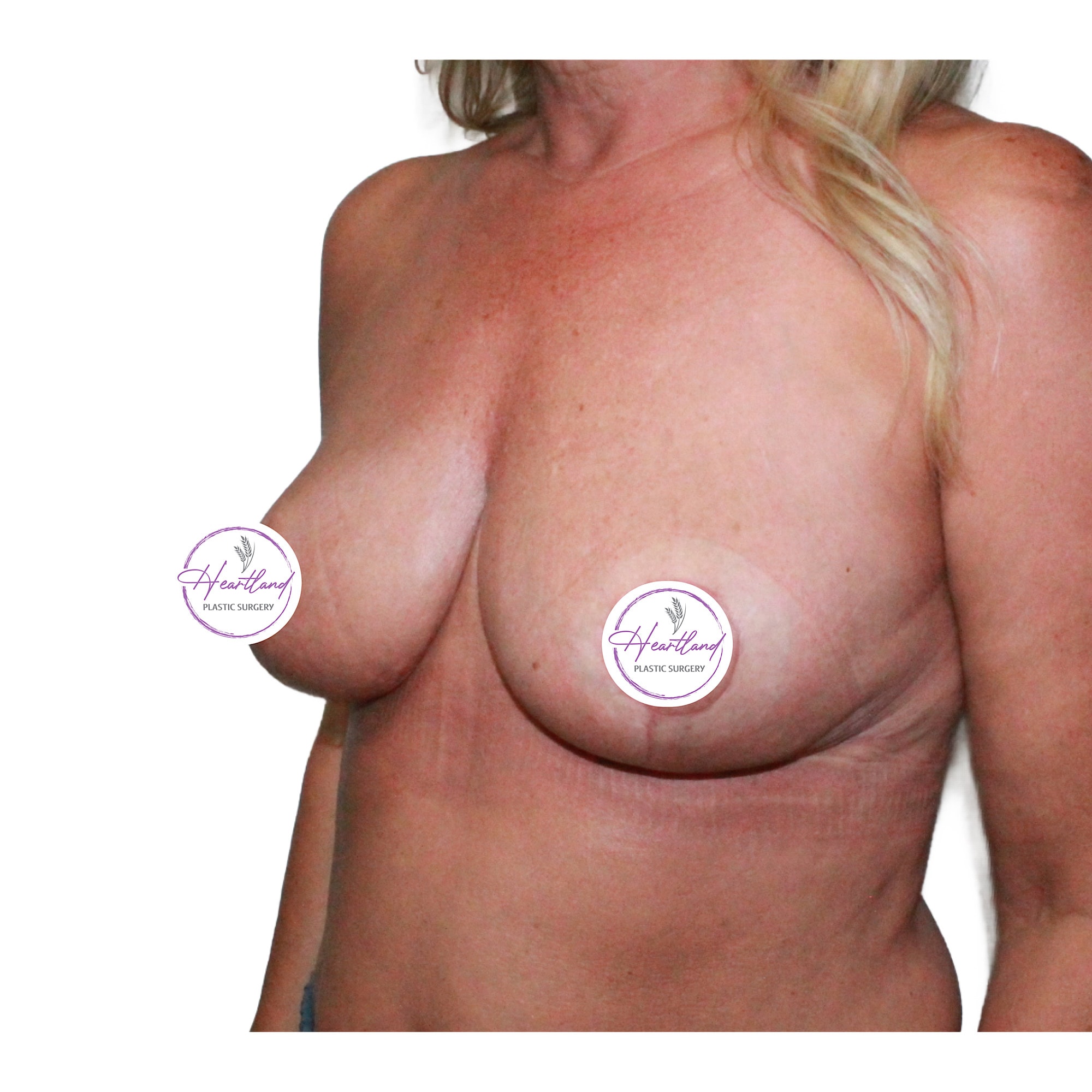 A result from Dr. Nataliya Biskup