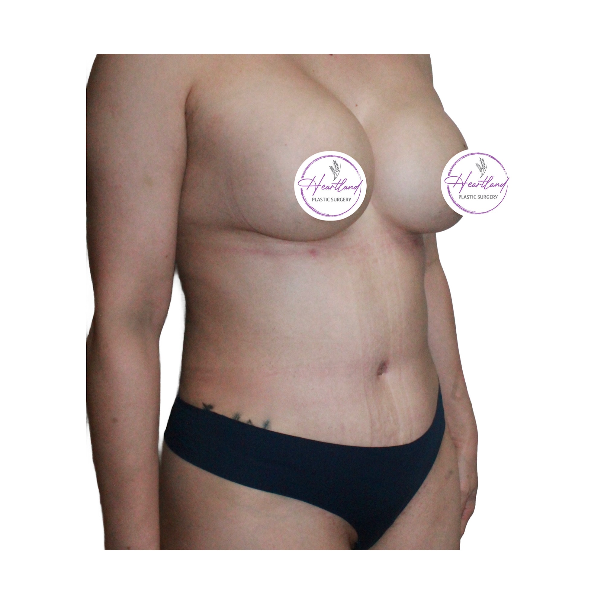 A result from Dr. Nataliya Biskup