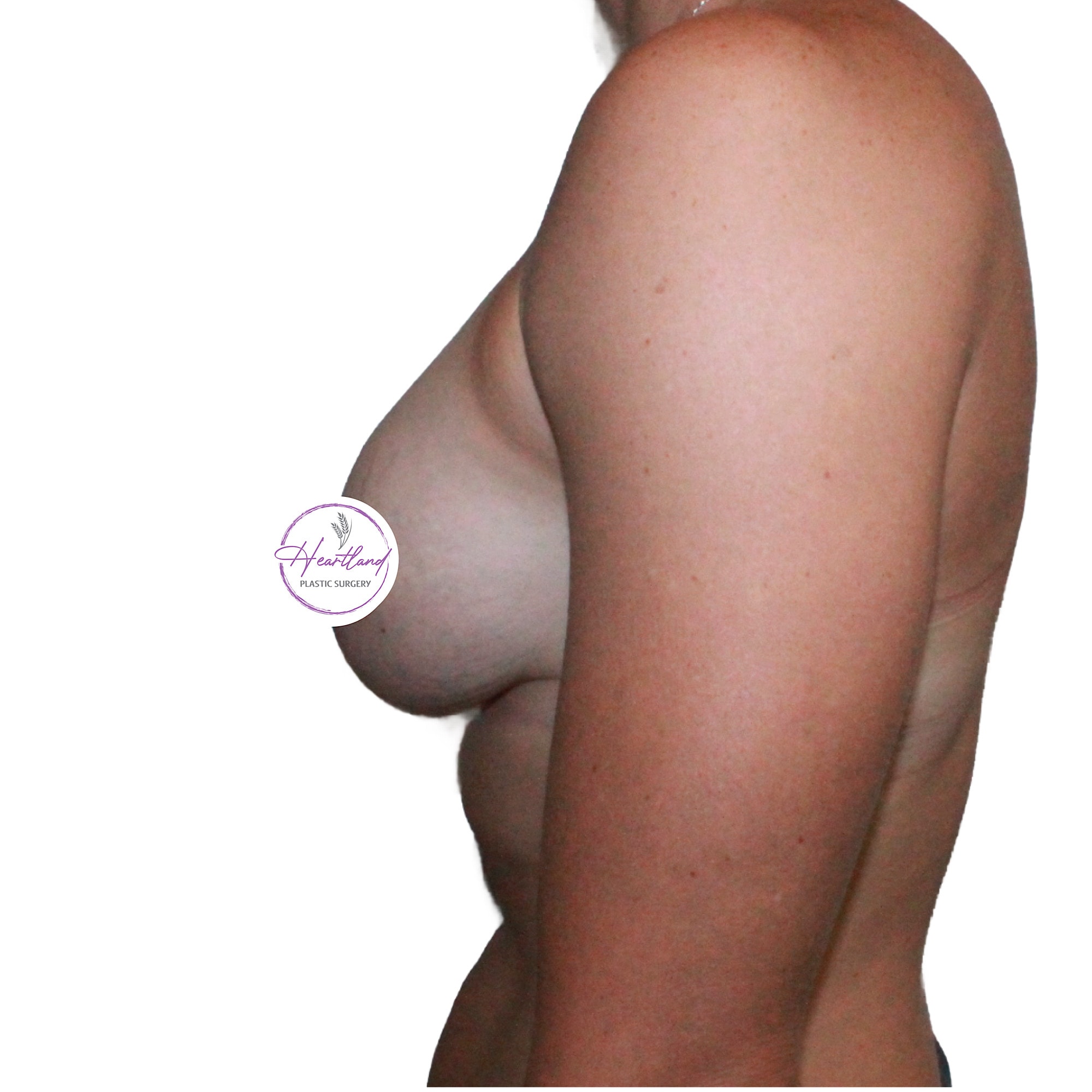 A result from Dr. Nataliya Biskup