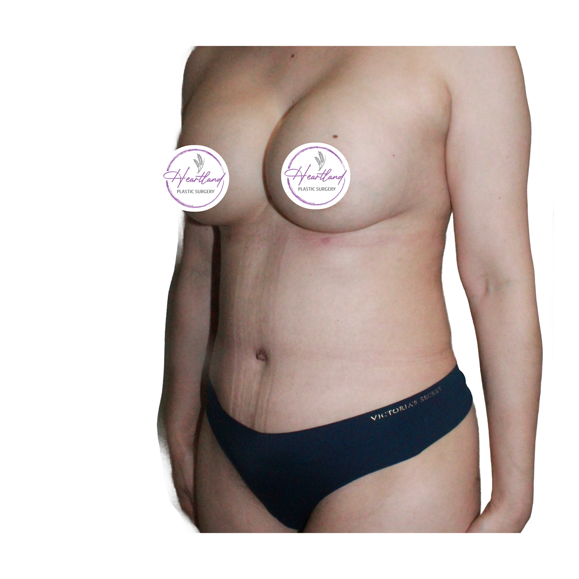 A result from Dr. Nataliya Biskup