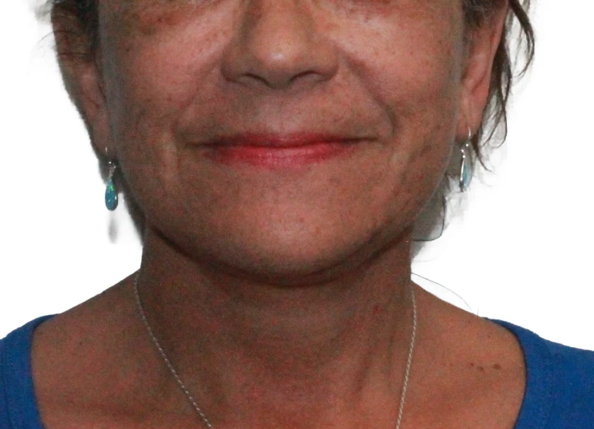 A result from Dr. Nataliya Biskup