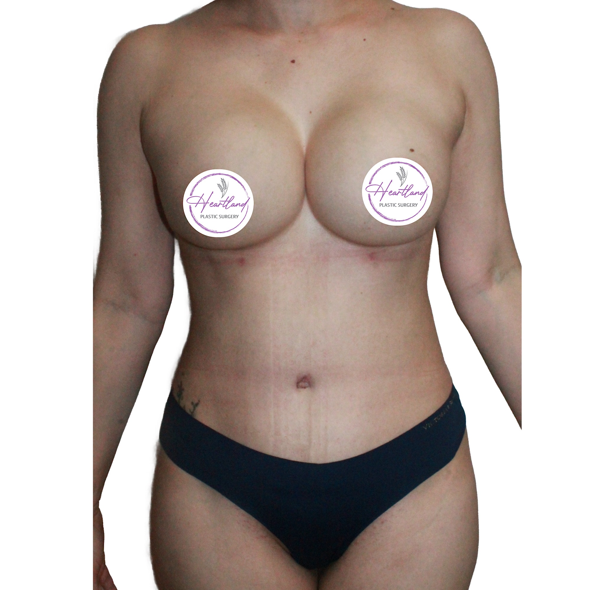 A result from Dr. Nataliya Biskup