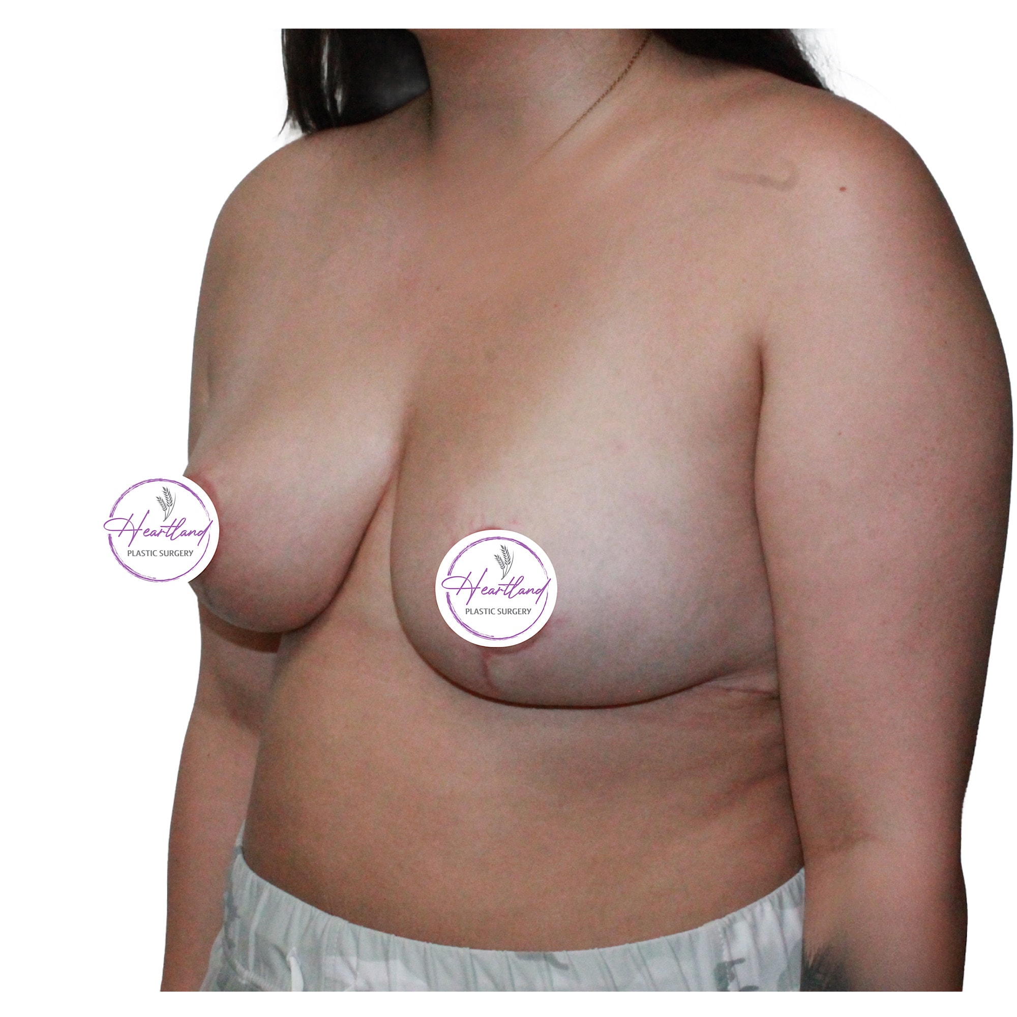 A result from Dr. Nataliya Biskup