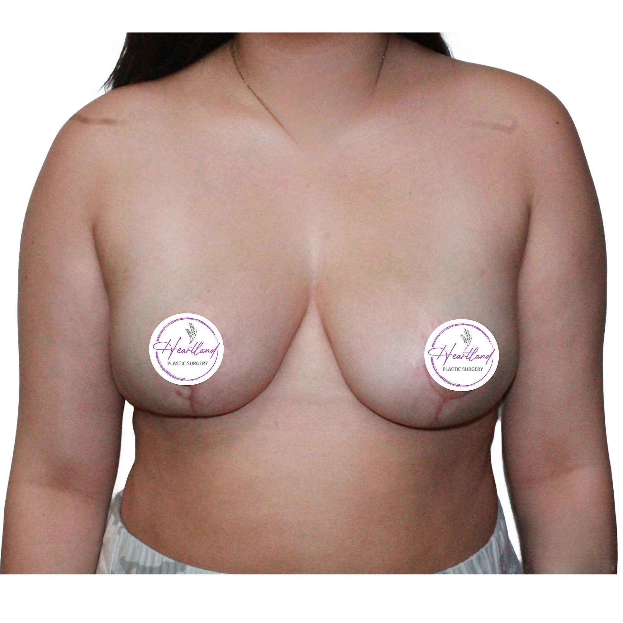 A result from Dr. Nataliya Biskup