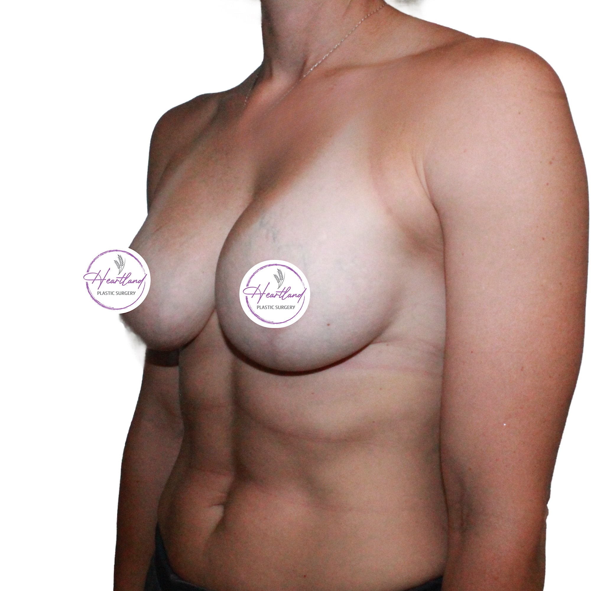 A result from Dr. Nataliya Biskup