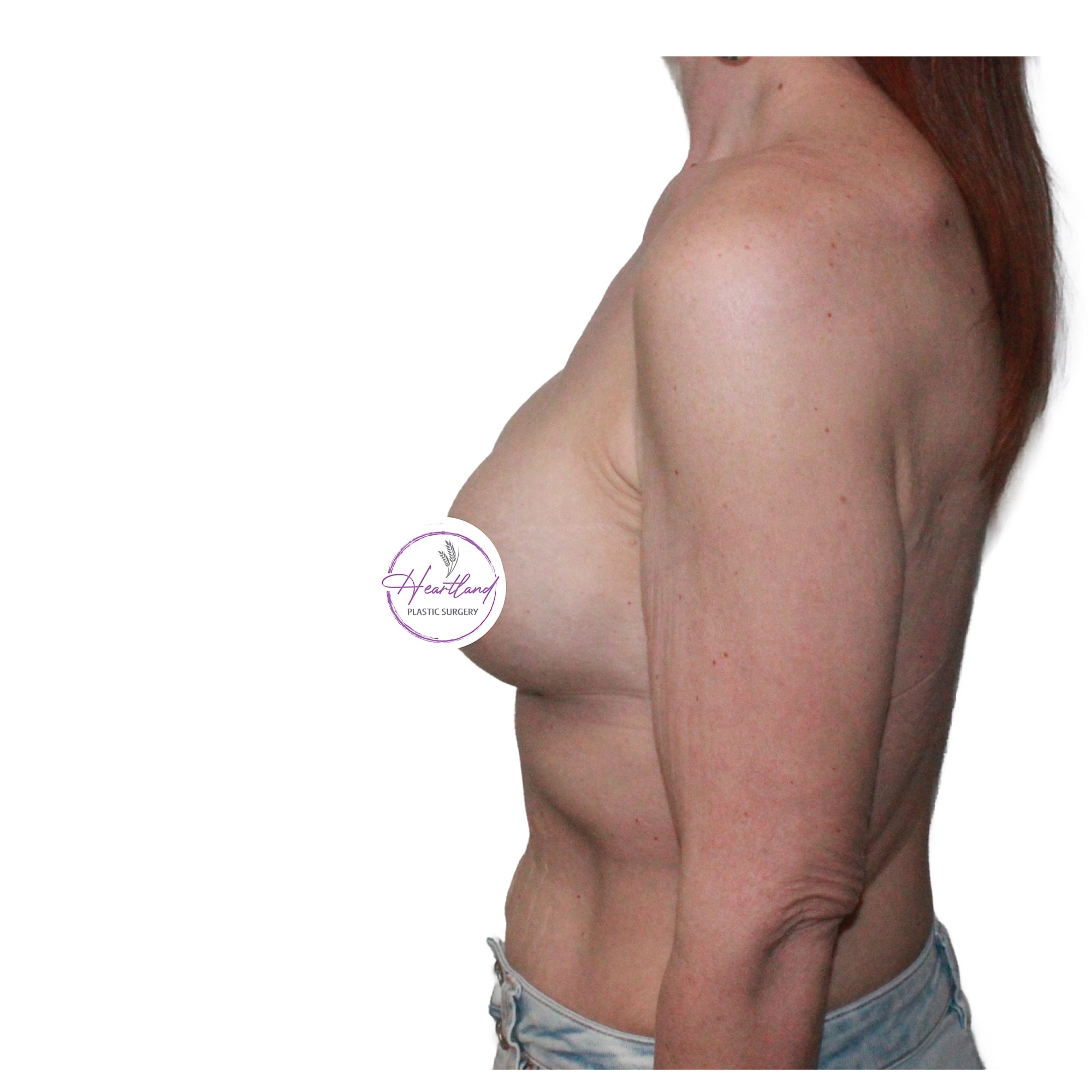 A result from Dr. Nataliya Biskup