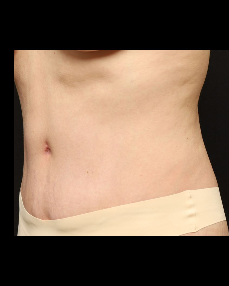 A result from The Rose Clinic