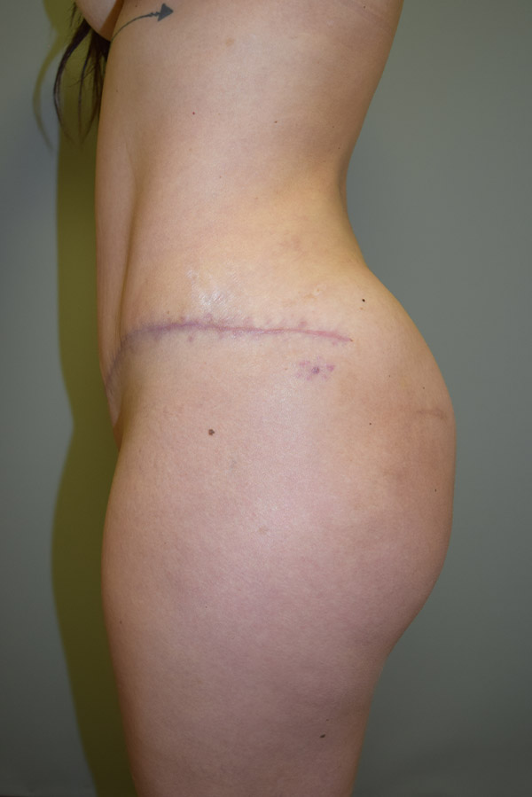 A result from The Rose Clinic