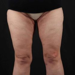 A result from My Houston Surgeons