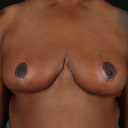 A result from My Houston Surgeons