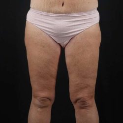 A result from My Houston Surgeons