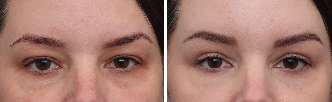 A result from Gold Coast Plastic Surgery