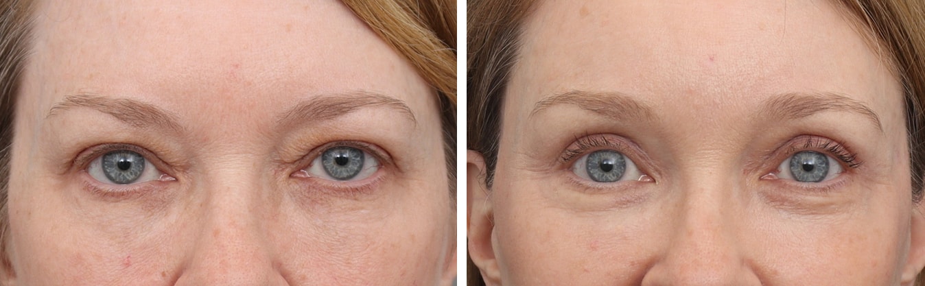 A result from Gold Coast Plastic Surgery