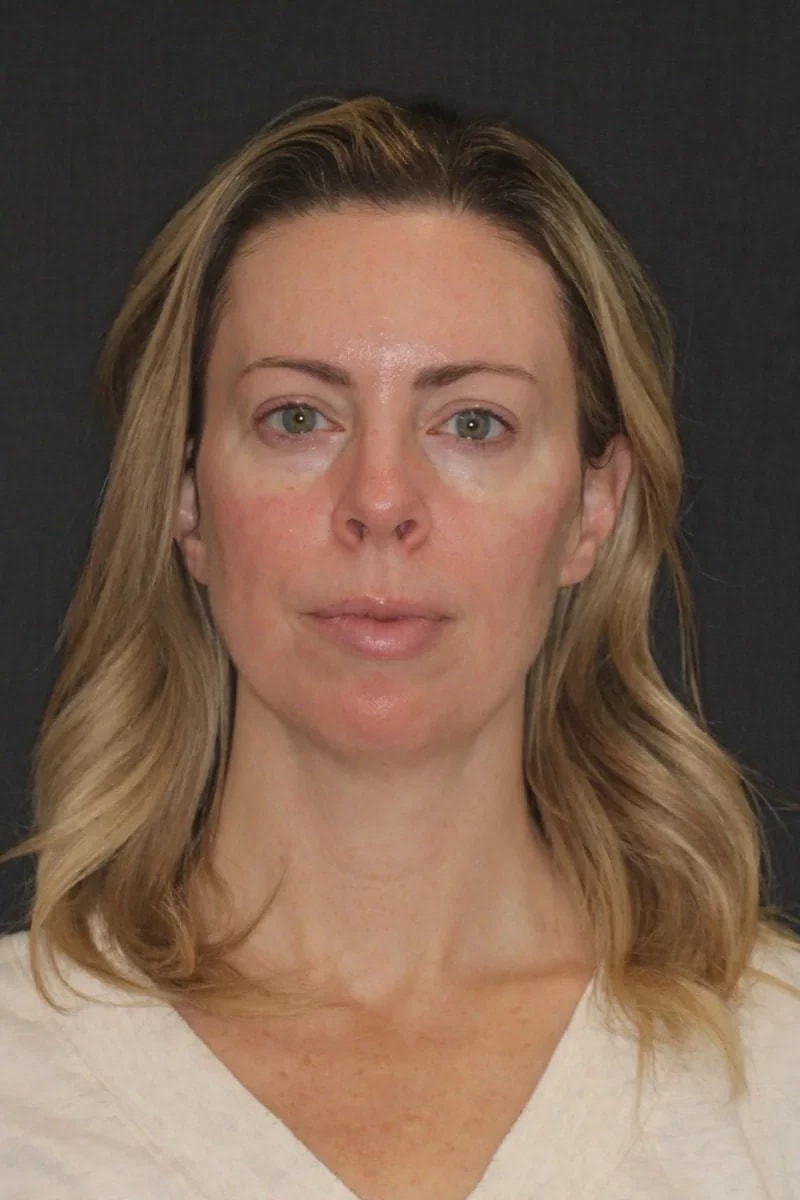A result from Advanced Dentistry and Aesthetics