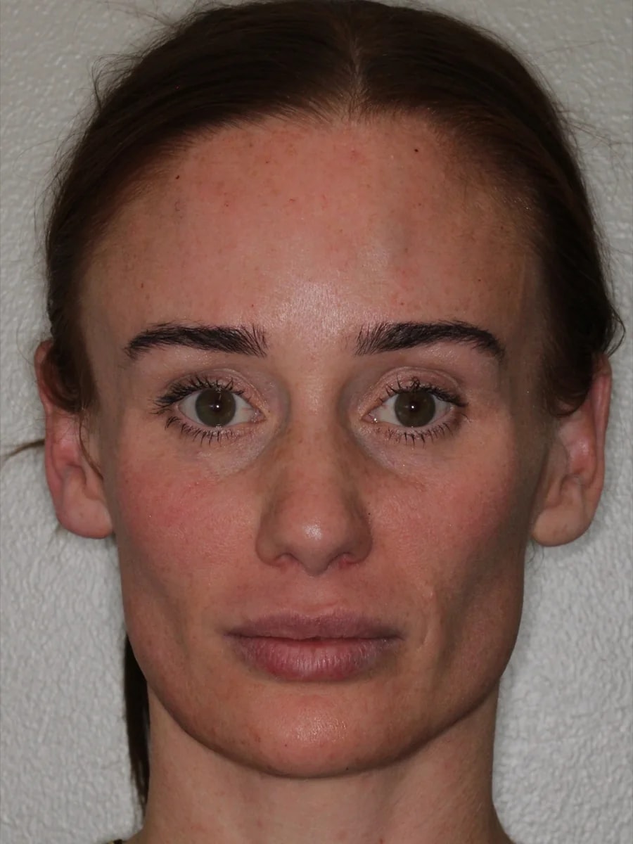 A result from Advanced Dentistry and Aesthetics